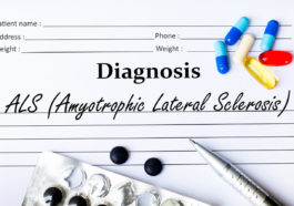 stages of amyotrophic lateral sclerosis